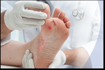 Diabetic Foot Treatment